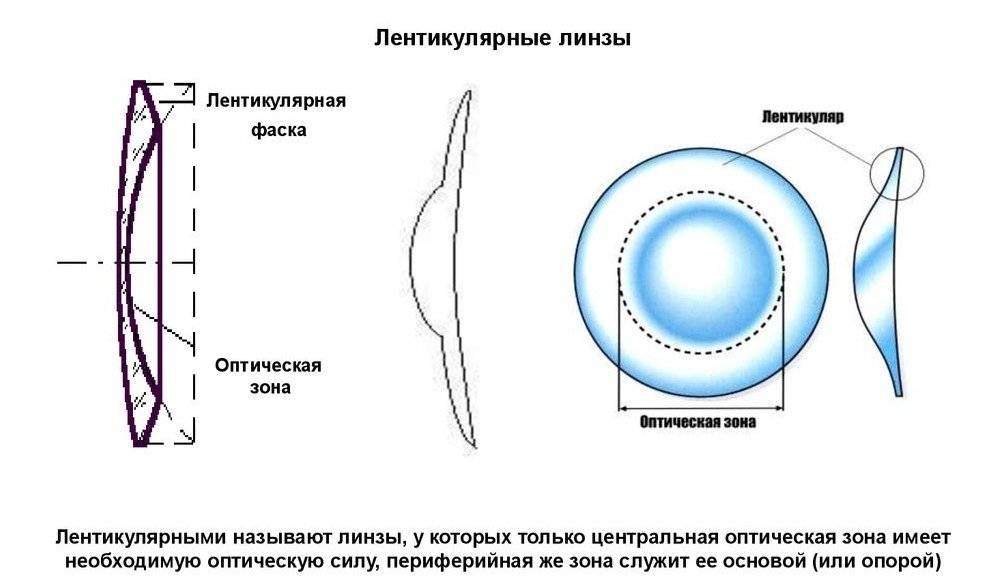 Как называются линзы изображенные на рисунке 381