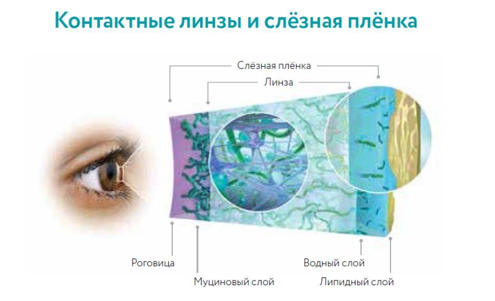 Контактные линзы с разным сроком замены и преимущества каждого из типов «ochkov.net»