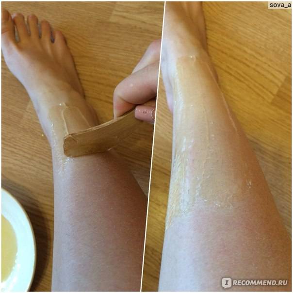 Как сделать кожу на ногах гладкой после эпиляции