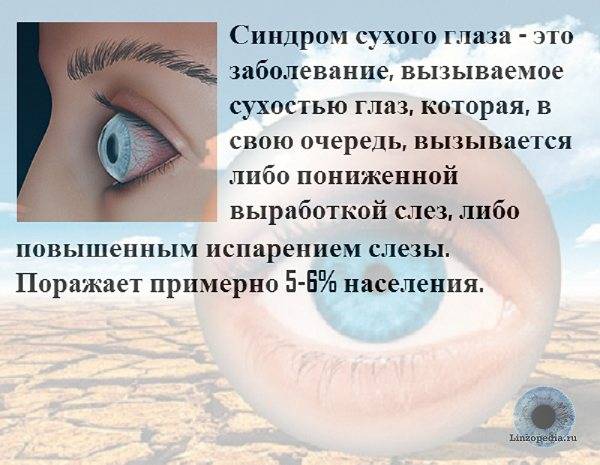 Линзы при сухости глаз. Синдром сухого глаза симптомы. Синдром сухого глаза причины.